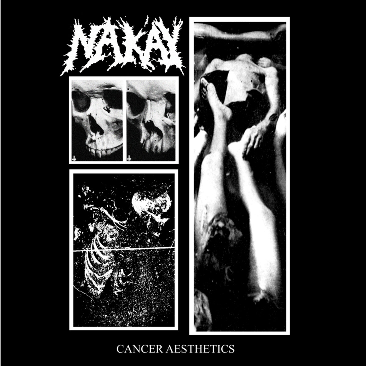 Nak'ay - Cancer Aethetics CD