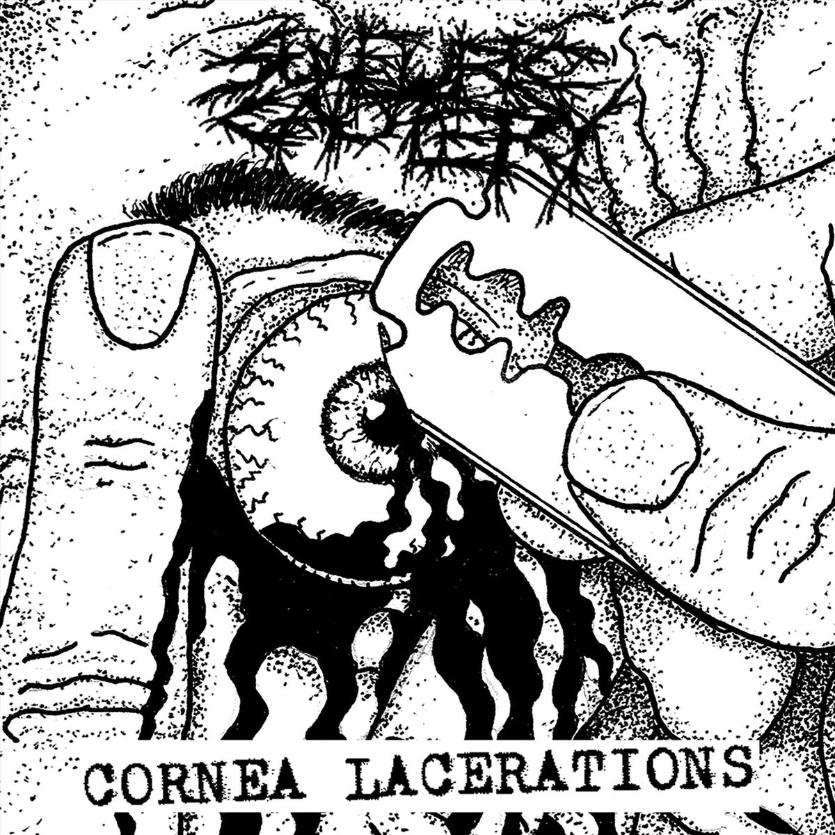 Sulfuric Cautery - Cornea Lacerations 7" Sulfuric Cautery - Cornea Lacerations 7"